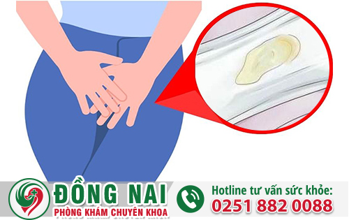 Âm Đạo Chảy Mủ Nguy Cơ Mắc Bệnh Lậu Cao