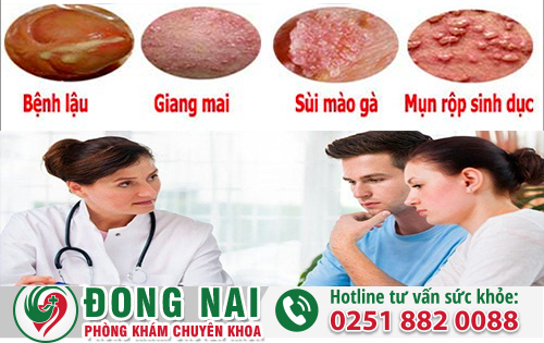 Các Triệu Chứng Bệnh Xã Hội Thường Gặp Ở Nam Và Nữ Giới