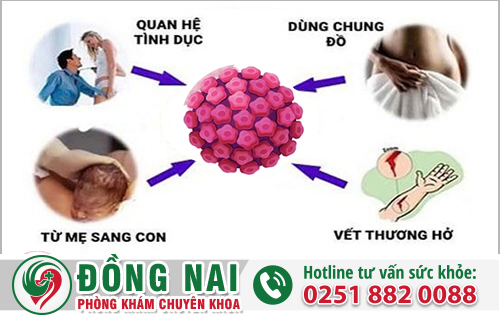 Nguyên Nhân Gây Sùi Mào Gà Ở Nữ Giới