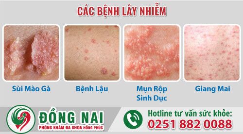 Bệnh lây nhiễm là gì? Bệnh lây nhiễm là những bệnh gì?