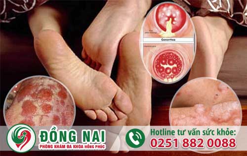da khoa hong phuc