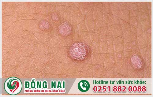 da khoa hong phuc