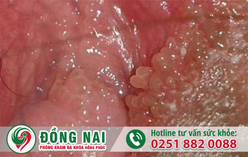 da khoa hong phuc