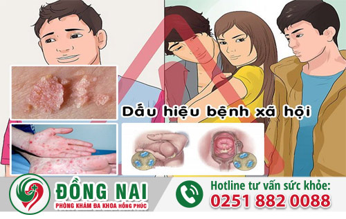 Các bệnh xã hội chủ yếu lây qua đường tình dục