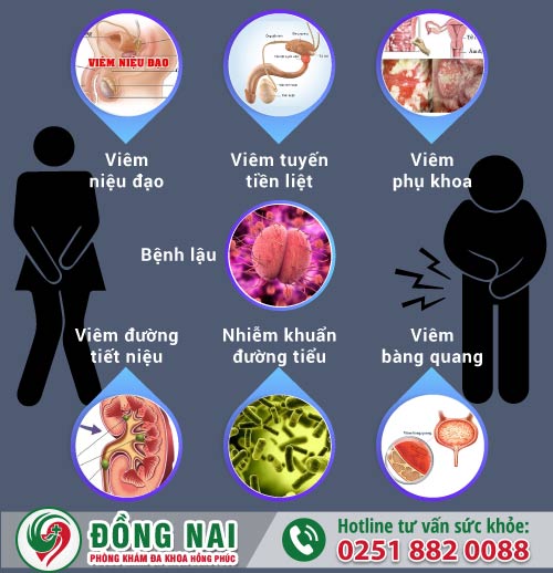 Cách chữa trị tiểu buốt hiệu quả