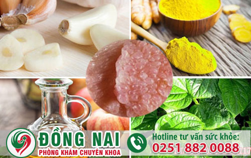 Có nên chữa sùi mào gà tại nhà không?
