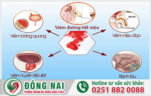 Đái ra máu là dấu hiệu của bệnh gì và cách điều trị ra sao?