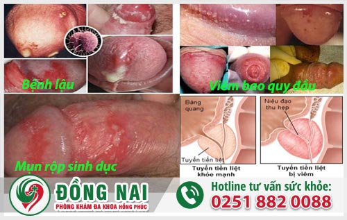 Đau dương vật - Dấu hiệu bệnh lý chớ nên xem nhẹ