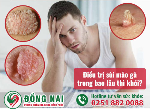 　　Điều trị sùi mào gà trong bao lâu thì khỏi?