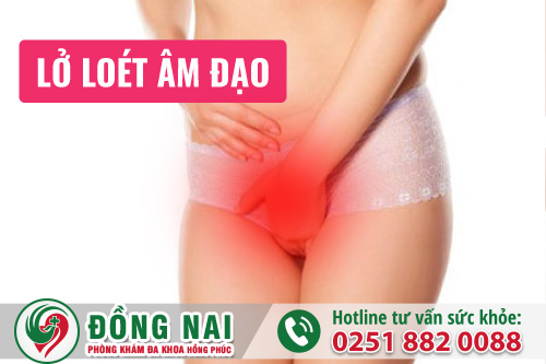 Lở loét âm đạo - Dấu hiệu nguy hiểm chị em cần chú ý