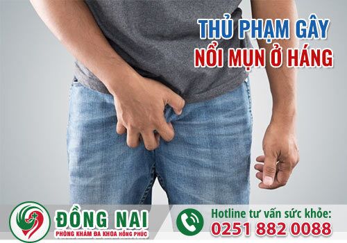 Thủ phạm gây nổi mụn ở háng và cách xử lý