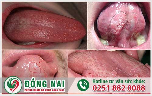 da khoa hong phuc