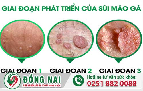 da khoa hong phuc