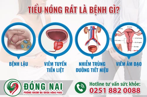 Đi tiểu ngứa rát là mắc bệnh gì? Điều trị ra sao?