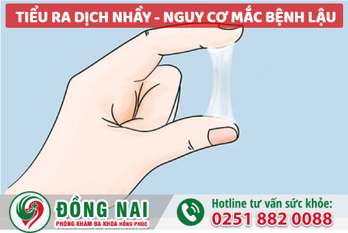 Tiểu ra dịch nhầy - Nguy cơ mắc bệnh lậu