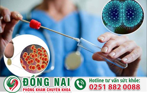 Xét Nghiệm Bệnh Lậu Phát Hiện Song Cầu Khuẩn Chính Xác
