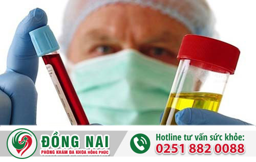Xét nghiệm bệnh xã hội tại Biên Hòa, Đồng Nai